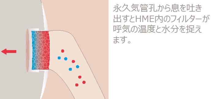 人工鼻（HME） - Atos Medical